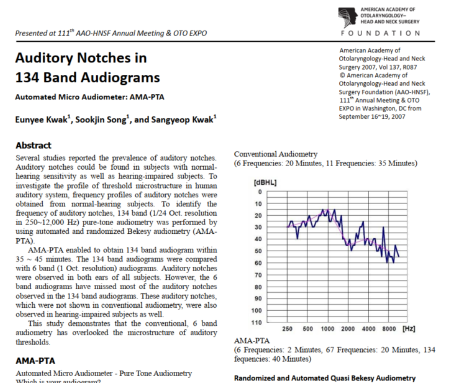 Auditory Notches in 134 Band Audiograms